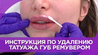 УДАЛЕНИЕ ТАТУАЖА ГУБ РЕМУВЕРОМ. Главные Ошибки Новичков. Инструкция от Татуэль