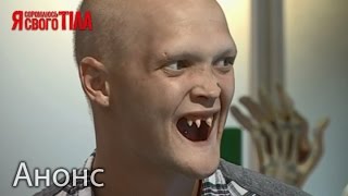 Улыбнуться на все 32. Невероятное перевоплощение! – Я стесняюсь своего тела. Анонс. Смотрите 21.4.16