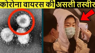 Corona Virus क्या है || कोरोना वायरस क्या है | CoronaVirus in hindi | What is Corona virus wuhan