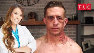 Doktor Çıbanım - Dr. Pimple Popper (1.Sezon 9.Bölüm)