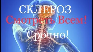 Склероз  Смотреть всем !   Срочно ! Доверяй Но проверяй.