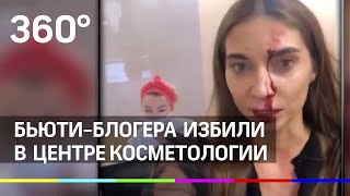 Известного блогера жестоко избили в Москве