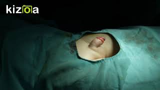 #Sünnət - #Циркумцизия - #Обрезание