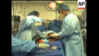 Jingle Luis has never walked on the bottoms of her feet.  The teen underwent surgery for her conditi