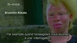 Stigmatisation des ALBINOS au Congo