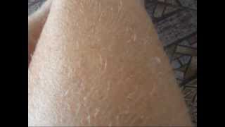 Pelos descoloridos