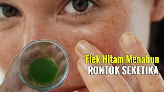 INI BEDA DARI YANG LAIN... FLEK HITAM MENAHUN RONTOK KULIT PUTIH HALUS SEKETIKA