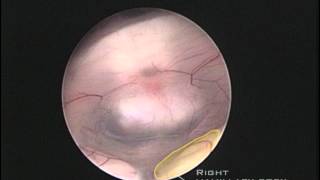 Endoscopic anatomy of the