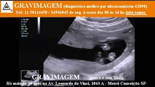GRAVIMAGEM 21569 Ultrassom morfolígico em gravidez 15 semanas mp1