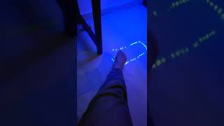 Me dragging my amputated leg
