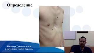 On-line лекция о воронкообразной деформации грудной клетки