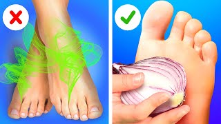 No more smelly feet! ???? || COOL FEET HACKS AND DIY SHOES