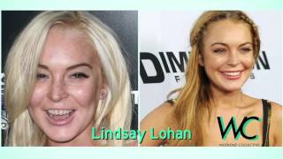 Celebs Who Have Fake Teeth