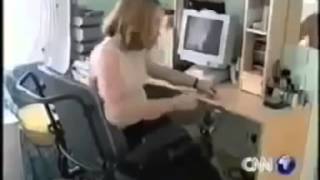 Woman Amputee 937