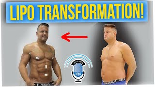 Man Gets Shredded Abs Overnight After Undergoing Transformational Treatment