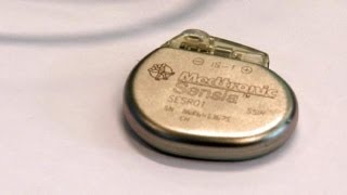 Tıpta yenilikçilik: mini kalp pilleri - hitech