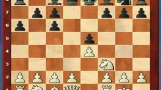 Chess Lesson #6, Part H (Ruy Lopez Part 2)