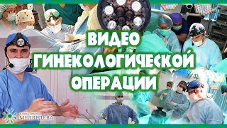 Меш сакровагинопексия