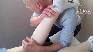 SEVERE Knee ARTHRITIS....HELPED and MANAGED with OSTEOPATHIC Care