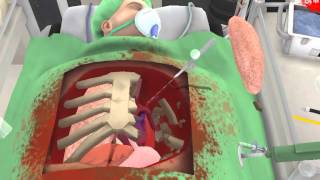 Surgeon Simulator Пересадка сердца