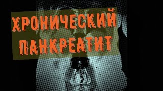 ХРОНИЧЕСКИЙ ПАНКРЕАТИТ на заключении МРТ брюшной полости. Как выглядит заключение МРТ.