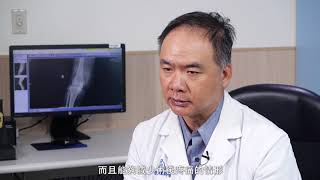 國人關節救星！英式活動半膝幫助早日擺脫疼痛、享受人生