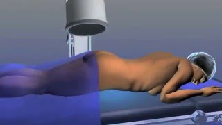 Tecnología Sin Límites | ¿Conoces los tratamientos para la incontinencia fecal?