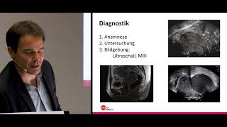 medArt2019: Donnerstag 08 B Fellmann Fischer Endometriose