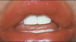 •Labios Gruesos• *Ultra poderoso y efectivo* (1 escucha) versión 2