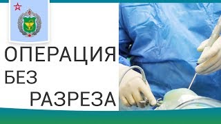 ? Этапы артроскопических операций и реабилитация после. Артроскопические операции. 12+