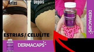 Dermacaps Antes e Depois - Dermacaps Bula Dermacaps onde Comprar
