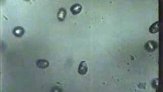 Diphylobothrium Life-cycle Part 1
