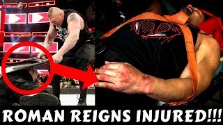 ROMAN REIGNS INJURED!!! | BROCK LESNAR Attacks ROMAN REIGNS!!!! |