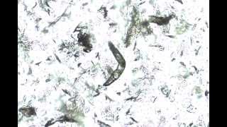 Demodex Laying Egg