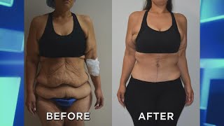 TSA’s Viral Instagram! Woman Lose 4 Dress Sizes Instantly? Jet Set Sexy w/beauty expert Shalini V…