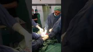 Diabetic foot amputation with Gigli saw. 2018