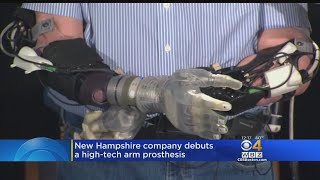 Company Debuts New Arm Prosthesis That Moves With Muscle Signals