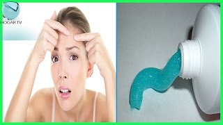 ? APLICA PASTA DENTAL EN TU CARA Y MIRA LO QUE PASA