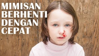 Cara Mudah Atasi Anak Sering Mimisan