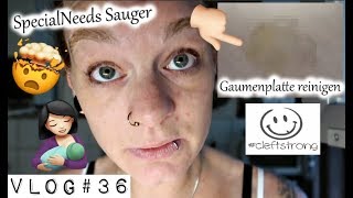 Alltag mit Baby | GAUMENPLATTE säubern | SpecialNeeds Sauger | #cleftproud