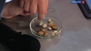 Камни в жёлчном пузыре - симптомы, причины и лечение