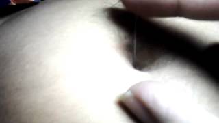 Needle in my navel