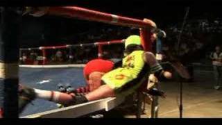 KATE OR DYE and the CRUNCH: a brutal roller derby injury!