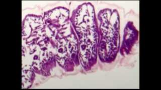 Bee metamorphosis: remarkable internal changes