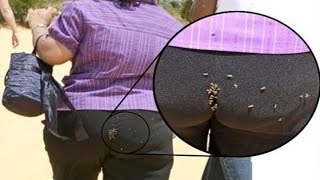 ЧТО БУДЕТ, ЕСЛИ ЗАШИТЬ АНАЛЬНОЕ ОТВЕРСТИЕ ЖЕСТЬ