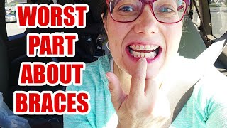 WORST thing about BRACES #seekyourtruth