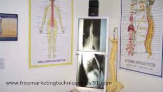 Marketing Ideas for Chiropractic Office