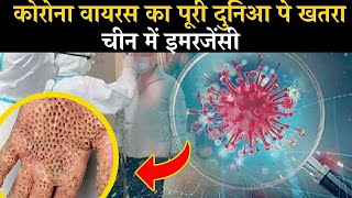 भारत में कैसे फैला Dangerous #Coronavirus, जिसका खतरा पूरी दुनिआ को पहुंच गया है