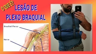 ? LESÃO DE PLEXO BRAQUIAL ♿ Descubra, Entenda, Compreenda