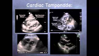 Tutorial: Basic echocardiography